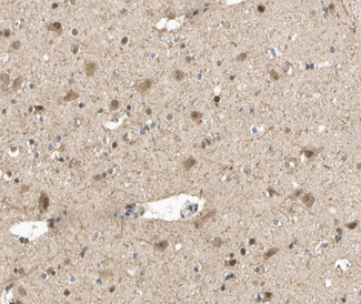 STAT5A Antibody - 1:200 staining human brain tissue by IHC-P. The tissue was formaldehyde fixed and a heat mediated antigen retrieval step in citrate buffer was performed. The tissue was then blocked and incubated with the antibody for 1.5 hours at 22° C. An HRP conjugated goat anti-rabbit antibody was used as the secondary.