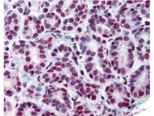 STAT5A Antibody - Immunohistochemistry of Monoclonal Anti-Stat5 pY694 Antibody. Tissue: human breast tissue (40X). Fixation: formalin fixed paraffin embedded (FFPE). Antigen retrieval: steam sections in 0.1 M sodium citrate buffer, pH 6, for 20 min. Rinse with 1XTBST. Primary antibody: Anti-Stat5pY694 at 20 µg/mL. Localization: breast epithelium with moderate nuclear staining. Staining: Stat5 pY694 as precipitated red signal, with a hematoxylin purple nuclear counterstain.