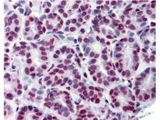 STAT5A Antibody - Immunohistochemistry using Anti-STAT5 pY694 monoclonal antibody shows detection of phosphorylated STAT5 pY694 in human breast tissue (40X). The antibody was used a dilution to 20 µg/mL. The image shows breast epithelium with moderate nuclear staining. Tissue was formalin fixed and paraffin embedded. No pre-treatment of sample was required. The image shows the localization of antibody as the precipitated red signal, with a hematoxylin purple nuclear counterstain.