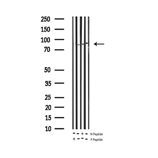 STAT5A Antibody - Western blot analysis of Phospho-STAT5A (Tyr694) expression in various lysates