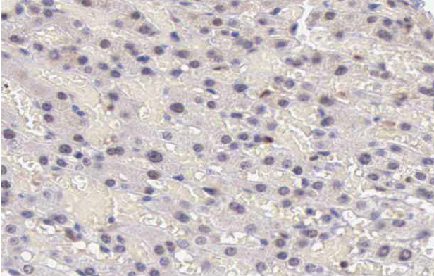 STAT5A Antibody - 1:100 staining human liver tissue by IHC-P. The tissue was formaldehyde fixed and a heat mediated antigen retrieval step in citrate buffer was performed. The tissue was then blocked and incubated with the antibody for 1.5 hours at 22°C. An HRP conjugated goat anti-rabbit antibody was used as the secondary.