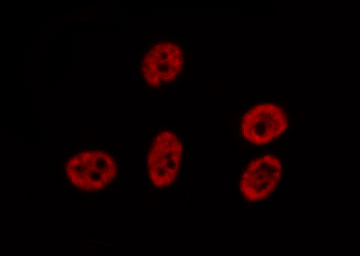 STAT5A Antibody - Staining RAW264.7 cells by IF/ICC. The samples were fixed with PFA and permeabilized in 0.1% Triton X-100, then blocked in 10% serum for 45 min at 25°C. The primary antibody was diluted at 1:200 and incubated with the sample for 1 hour at 37°C. An Alexa Fluor 594 conjugated goat anti-rabbit IgG (H+L) Ab, diluted at 1/600, was used as the secondary antibody.