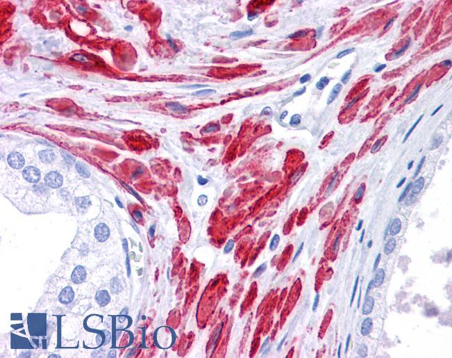 STAT5B Antibody - Anti-STAT5B antibody IHC of human prostate. Immunohistochemistry of formalin-fixed, paraffin-embedded tissue after heat-induced antigen retrieval. Antibody concentration 5 ug/ml.  This image was taken for the unconjugated form of this product. Other forms have not been tested.