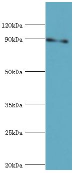 STAT5B Antibody - Western blot. All lanes: Signal transducer and activator of transcription 5B antibody at 16 ug/ml+HeLa whole cell lysate. Secondary antibody: Goat polyclonal to rabbit at 1:10000 dilution. Predicted band size: 90 kDa. Observed band size: 90 kDa.