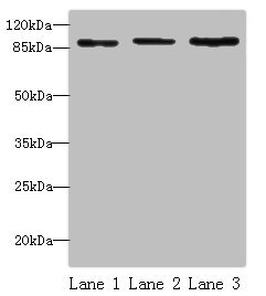 STAT5B Antibody - Western blot All lanes: STAT5B antibody at 16 µg/ml Lane 1: HepG2 whole cell lysate Lane 2: K562 whole cell lysate Lane 3: Hela whole cell lysate Secondary Goat polyclonal to rabbit IgG at 1/10000 dilution Predicted band size: 90 kDa Observed band size: 90 kDa