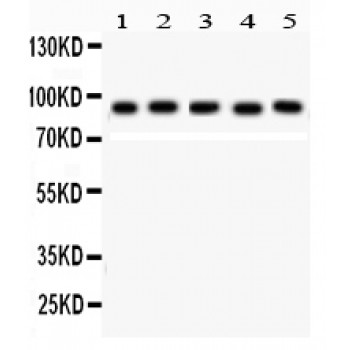 STAT5B Antibody - STAT5b antibody Western blot. All lanes: Anti STAT5b at 0.5 ug/ml. Lane 1: Rat Lung Tissue Lysate at 50 ug. Lane 2: Rat Kidney Tissue Lysate at 50 ug. Lane 3: PANC Whole Cell Lysate at 40 ug. Lane 4: MM231 Whole Cell Lysate at 40 ug. Lane 5: COLO320 Whole Cell Lysate at 40 ug. Predicted band size: 90 kD. Observed band size: 90 kD.