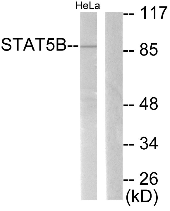 STAT5B Antibody - Western blot analysis of lysates from HeLa, using STAT5B Antibody. The lane on the right is blocked with the synthesized peptide.