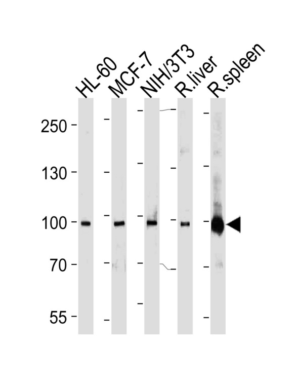 STAT5B Antibody - STAT5b Antibody western blot of HL-60,MCF-7,mouse NIH/3T3 cell line, rat liver and spleen lysates (35 ug/lane). The STAT5b antibody detected the STAT5b protein (arrow).