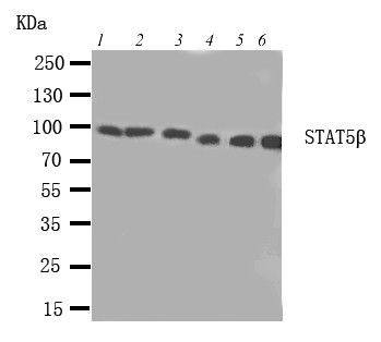STAT5B Antibody - WB of STAT5B / STAT antibody. Lane 1: Rat Intestine Tissue Lysate. Lane 2: Rat Kidney Tissue Lysate. Lane 3: HELA Cell Lysate. Lane 4: A549 Cell Lysate. Lane 5: MM231 Cell Lysate. Lane 6: COLO320 Cell Lysate.