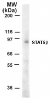 STAT5B Antibody - Western blot of Stat5b in 10 ug of Jurkat cell lysate using 1 ug/ml antibody. Immunoreaction was detected by chemiluminescence