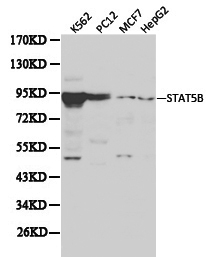 STAT5B Antibody - Western blot of STAT5B pAb in extracts from K562, PC12, MCF7 and HepG2 cells.