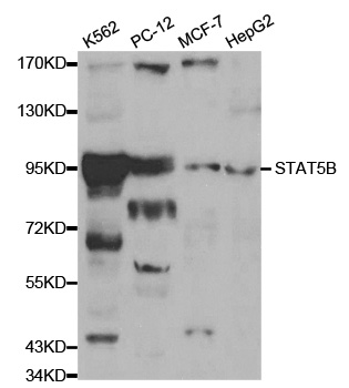 STAT5B Antibody - Western blot analysis of extracts of various cell lines, using STAT5B antibody at 1:1000 dilution. The secondary antibody used was an HRP Goat Anti-Rabbit IgG (H+L) at 1:10000 dilution. Lysates were loaded 25ug per lane and 3% nonfat dry milk in TBST was used for blocking.