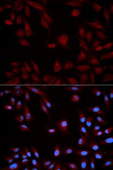 STAT5B Antibody - Immunofluorescence analysis of HeLa cells using STAT5B antibody. Blue: DAPI for nuclear staining.