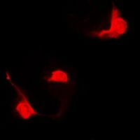 STAT5B Antibody - Immunofluorescent analysis of STAT5B staining in HeLa cells. Formalin-fixed cells were permeabilized with 0.1% Triton X-100 in TBS for 5-10 minutes and blocked with 3% BSA-PBS for 30 minutes at room temperature. Cells were probed with the primary antibody in 3% BSA-PBS and incubated overnight at 4 deg C in a humidified chamber. Cells were washed with PBST and incubated with a DyLight 594-conjugated secondary antibody (red) in PBS at room temperature in the dark.