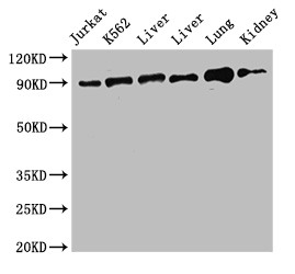 STAT5B Antibody - Positive WB detected in:Jurkat whole cell lysate,K562 whole cell lysate,Rat liver tissue,Mouse liver tiaaue,Mouse lung tissue,Mouse kidney tissue;All lanes:STAT5B antibody at 2.4?g/ml;Secondary;Goat polyclonal to rabbit IgG at 1/50000 dilution;Predicted band size: 90 KDa;Observed band size: 90 KDa;
