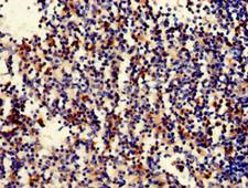 STAT5B Antibody - Immunohistochemistry of paraffin-embedded human spleen tissue using STAT5B Antibody at dilution of 1:100
