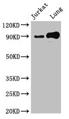 STAT5B Antibody - Western Blot Positive WB detected in: Jurkat whole cell lysate, Mouse lung tissue All lanes: STAT5B antibody at 2.4µg/ml Secondary Goat polyclonal to rabbit IgG at 1/50000 dilution Predicted band size: 90 kDa Observed band size: 90 kDa