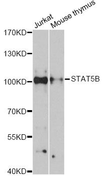 STAT5B Antibody - Western blot analysis of extracts of various cell lines, using STAT5B antibody at 1:3000 dilution. The secondary antibody used was an HRP Goat Anti-Rabbit IgG (H+L) at 1:10000 dilution. Lysates were loaded 25ug per lane and 3% nonfat dry milk in TBST was used for blocking. An ECL Kit was used for detection and the exposure time was 90s.