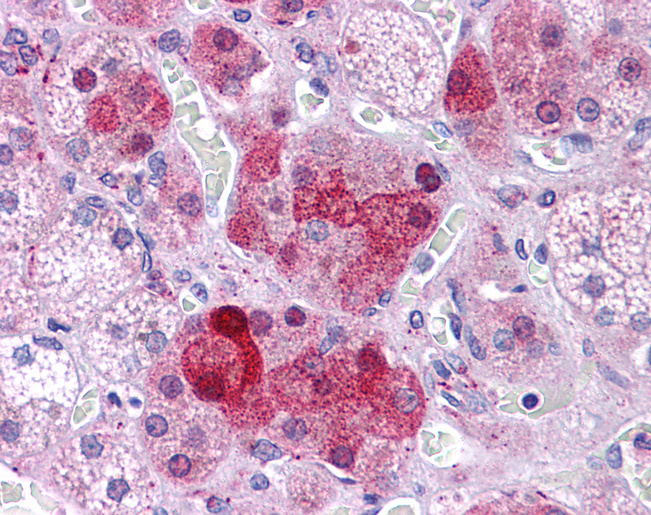 STAT5B Antibody - Human Adrenal: Formalin-Fixed, Paraffin-Embedded (FFPE).  This image was taken for the unconjugated form of this product. Other forms have not been tested.