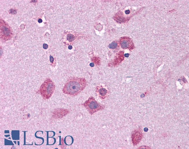 STAT5B Antibody - Human Brain, Cortex: Formalin-Fixed, Paraffin-Embedded (FFPE).  This image was taken for the unconjugated form of this product. Other forms have not been tested.