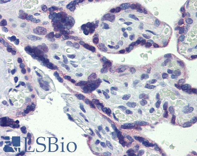 STAT5B Antibody - Anti-STAT5B antibody IHC of human placenta. Immunohistochemistry of formalin-fixed, paraffin-embedded tissue after heat-induced antigen retrieval. Antibody concentration 5 ug/ml.  This image was taken for the unconjugated form of this product. Other forms have not been tested.