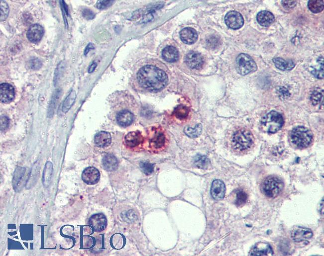 STAT5B Antibody - Anti-STAT5B antibody IHC of human testis. Immunohistochemistry of formalin-fixed, paraffin-embedded tissue after heat-induced antigen retrieval. Antibody concentration 5 ug/ml.  This image was taken for the unconjugated form of this product. Other forms have not been tested.