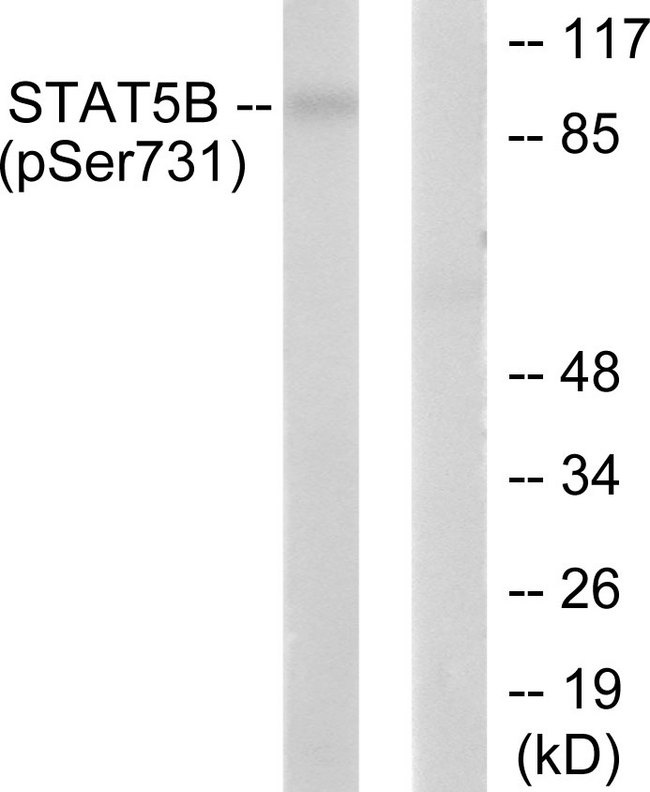STAT5B Antibody - Western blot analysis of lysates from RAW264.7 cells treated with EGF 200ng/ml 30', using STAT5B (Phospho-Ser731) Antibody. The lane on the right is blocked with the phospho peptide.