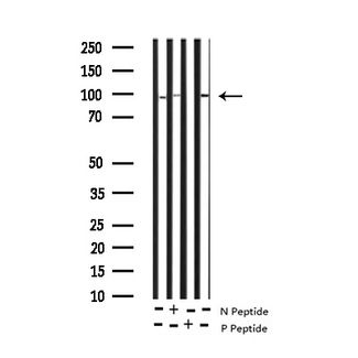 STAT5B Antibody - Western blot analysis of Phospho-STAT5B (Ser731) expression in various lysates