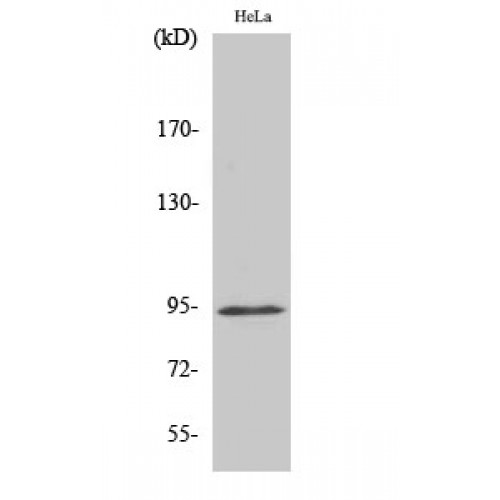 STAT6 Antibody - Western blot of Phospho-Stat6 (Y641) antibody