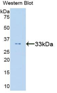 STAT6 Antibody - Western blot of recombinant STAT6.  This image was taken for the unconjugated form of this product. Other forms have not been tested.