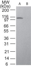 STAT6 Antibody - Western Blot: STAT6 Antibody (177C322.1) - Analysis of STAT6 in HeLa lysate in the A) absence and B) presence of immunizing peptide using STAT6 antibody at 2 ug/ml. anti mouse Ig HRP secondary antibody and ECL substrate were used for this test.  This image was taken for the unconjugated form of this product. Other forms have not been tested.