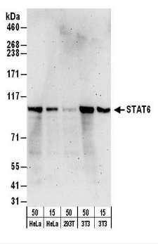 STAT6 Antibody - Detection of Human and Mouse STAT6 by Western Blot. Samples: Whole cell lysate from HeLa (15 and 50 ug), 293T (50 ug), and mouse NIH3T3 (15 and 50 ug) cells. Antibodies: Affinity purified rabbit anti-STAT6 antibody used for WB at 0.1 ug/ml. Detection: Chemiluminescence with an exposure time of 3 minutes.