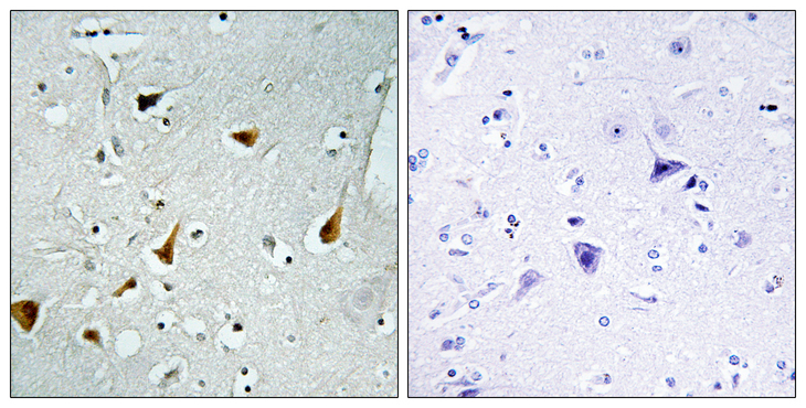 STAT6 Antibody - Immunohistochemistry analysis of paraffin-embedded human brain tissue, using STAT6 Antibody. The picture on the right is blocked with the synthesized peptide.