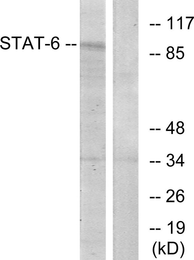 STAT6 Antibody - Western blot analysis of lysates from HeLa cells, using STAT6 Antibody. The lane on the right is blocked with the synthesized peptide.