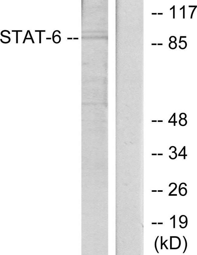 STAT6 Antibody - Western blot analysis of lysates from HeLa cells, using STAT6 Antibody. The lane on the right is blocked with the synthesized peptide.