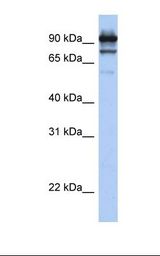 STAT6 Antibody - Hela cell lysate. Antibody concentration: 1.0 ug/ml. Gel concentration: 12%.  This image was taken for the unconjugated form of this product. Other forms have not been tested.