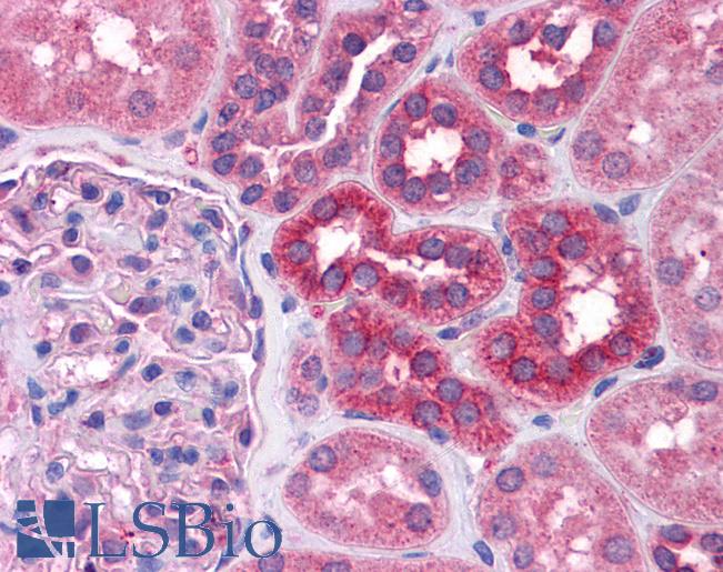 STAT6 Antibody - Anti-STAT6 antibody IHC of human kidney. Immunohistochemistry of formalin-fixed, paraffin-embedded tissue after heat-induced antigen retrieval. Antibody concentration 5 ug/ml.  This image was taken for the unconjugated form of this product. Other forms have not been tested.