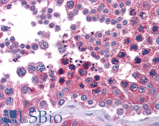 STAT6 Antibody - Anti-STAT6 antibody IHC of human testis. Immunohistochemistry of formalin-fixed, paraffin-embedded tissue after heat-induced antigen retrieval. Antibody concentration 5 ug/ml.  This image was taken for the unconjugated form of this product. Other forms have not been tested.