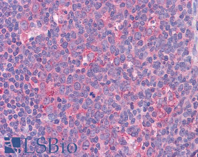 STAT6 Antibody - Anti-STAT6 antibody IHC of human tonsil. Immunohistochemistry of formalin-fixed, paraffin-embedded tissue after heat-induced antigen retrieval. Antibody concentration 5 ug/ml.  This image was taken for the unconjugated form of this product. Other forms have not been tested.