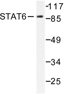 STAT6 Antibody - Western blot of STAT6 (R639) pAb in extracts from HeLa cells.