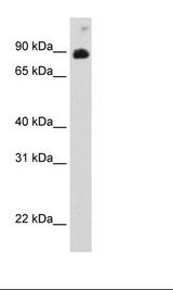 STAT6 Antibody - Recombinant STAT6 Protein Cell Lysate.  This image was taken for the unconjugated form of this product. Other forms have not been tested.