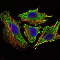 STAT6 Antibody - Immunofluorescence of HeLa cells using STAT6 mouse monoclonal antibody (green). Blue: DRAQ5 fluorescent DNA dye. Red: Actin filaments have been labeled with Alexa Fluor-555 phalloidin