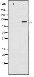 STAT6 Antibody - Western blot of STAT6 expression in HeLa whole cell lysates,The lane on the left is treated with the antigen-specific peptide.