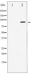 STAT6 Antibody - Western blot of STAT6 expression in HeLa whole cell lysates,The lane on the left is treated with the antigen-specific peptide.