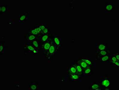 STAT6 Antibody - Immunofluorescent analysis of HepG2 cells at a dilution of 1:100 and Alexa Fluor 488-congugated AffiniPure Goat Anti-Rabbit IgG(H+L)