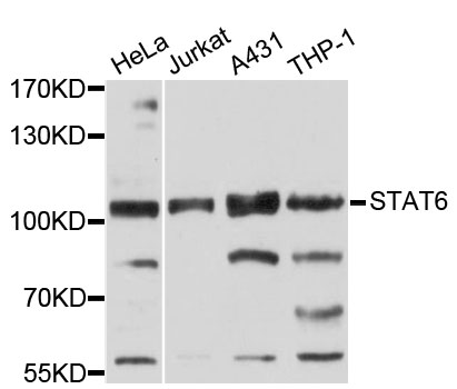 STAT6 Antibody - Western blot analysis of extracts of various cell lines, using STAT6 antibody at 1:3000 dilution. The secondary antibody used was an HRP Goat Anti-Rabbit IgG (H+L) at 1:10000 dilution. Lysates were loaded 25ug per lane and 3% nonfat dry milk in TBST was used for blocking. An ECL Kit was used for detection and the exposure time was 90s.