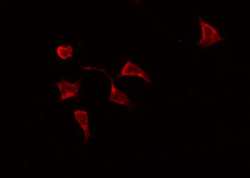 STAT6 Antibody - Staining HeLa cells by IF/ICC. The samples were fixed with PFA and permeabilized in 0.1% Triton X-100, then blocked in 10% serum for 45 min at 25°C. The primary antibody was diluted at 1:200 and incubated with the sample for 1 hour at 37°C. An Alexa Fluor 594 conjugated goat anti-rabbit IgG (H+L) Ab, diluted at 1/600, was used as the secondary antibody.