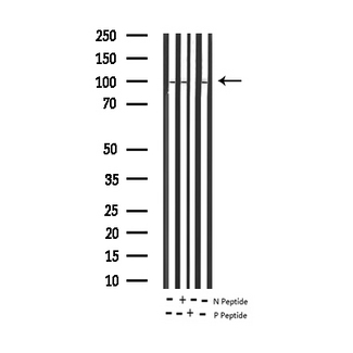 STAT6 Antibody - Western blot analysis of F8 expression in various lysates