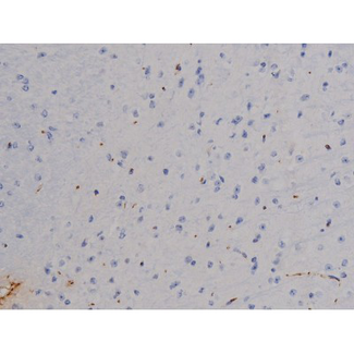 STAT6 Antibody - 1:200 staining mouse brain tissue by IHC-P. The tissue was formaldehyde fixed and a heat mediated antigen retrieval step in citrate buffer was performed. The tissue was then blocked and incubated with the antibody for 1.5 hours at 22°C. An HRP conjugated goat anti-rabbit antibody was used as the secondary.