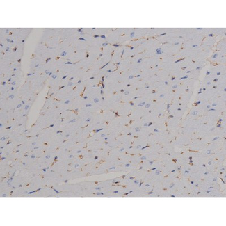 STAT6 Antibody - 1:200 staining mouse heart tissue by IHC-P. The tissue was formaldehyde fixed and a heat mediated antigen retrieval step in citrate buffer was performed. The tissue was then blocked and incubated with the antibody for 1.5 hours at 22°C. An HRP conjugated goat anti-rabbit antibody was used as the secondary.